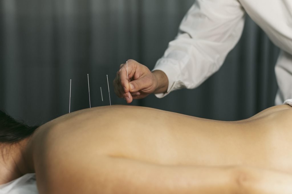 Acupuncturist in Middelburg